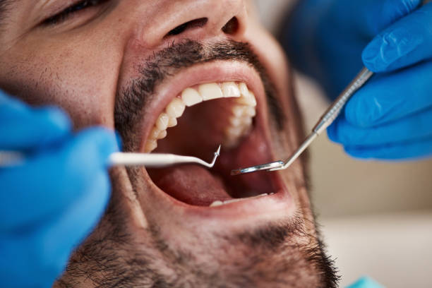 Best Emergency Gum Treatment in Fairbury, NE